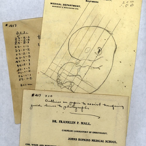 Franklin Mall’s manuscript notes for human embryo Specimen #417 in the Carnegie Collection of Human Embryos.